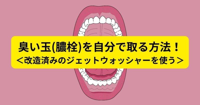 臭い玉(膿栓)を自分で取る方法！＜改造済みのジェットウォッシャーを使う＞